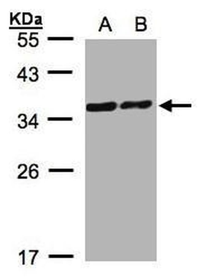 PDLIM1 Antibody in Western Blot (WB)