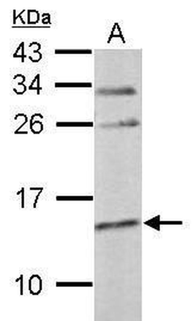 Cystatin C Antibody in Western Blot (WB)