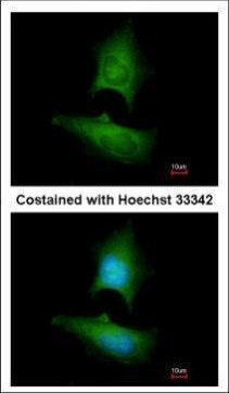 LPIN1 Antibody in Immunocytochemistry (ICC/IF)