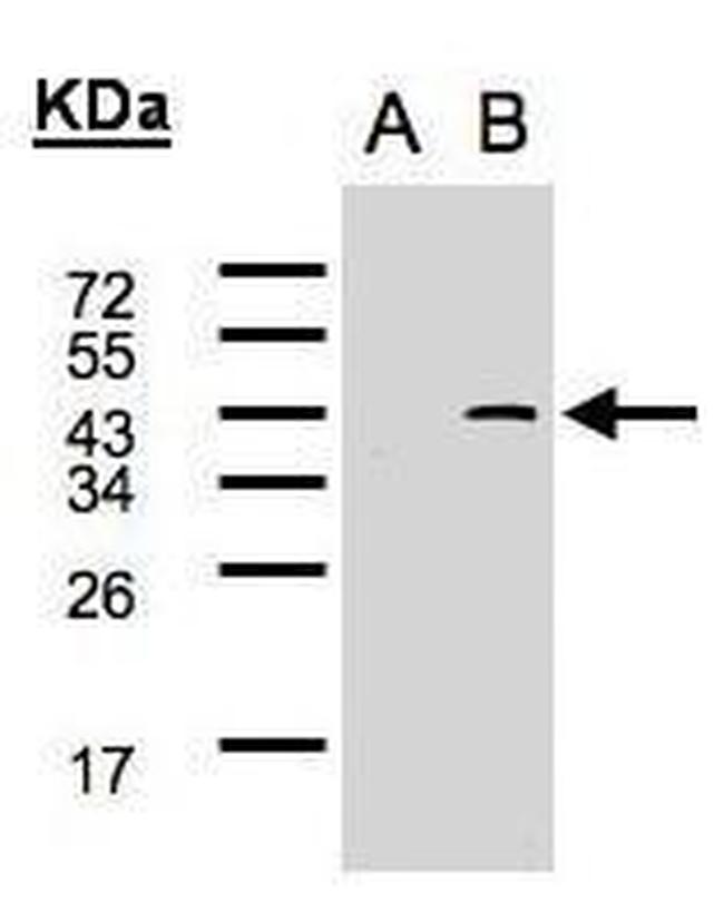SYF2 Antibody in Western Blot (WB)