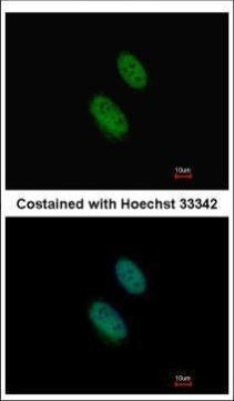 EZH1 Antibody in Immunocytochemistry (ICC/IF)