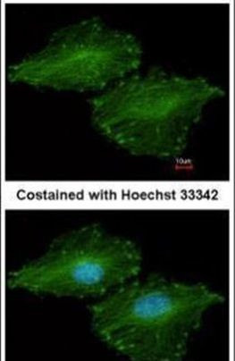 UBE2O Antibody in Immunocytochemistry (ICC/IF)