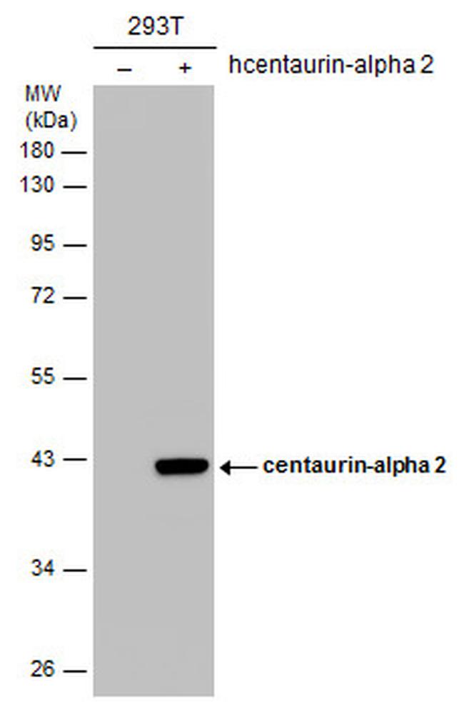 Centaurin alpha-2 Antibody in Western Blot (WB)