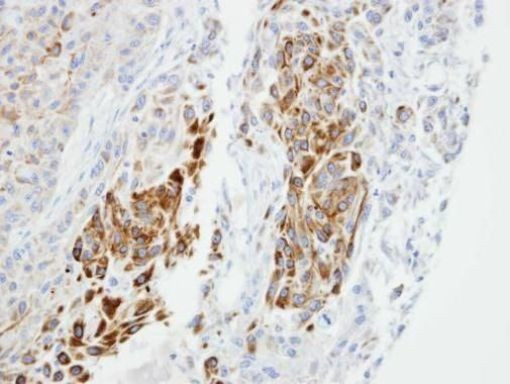 NEDL2 Antibody in Immunohistochemistry (Paraffin) (IHC (P))