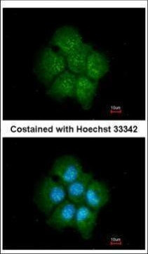 TAB182 Antibody in Immunocytochemistry (ICC/IF)