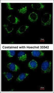 GPR32 Antibody in Immunocytochemistry (ICC/IF)