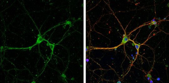 mGluR8 Antibody in Immunocytochemistry (ICC/IF)