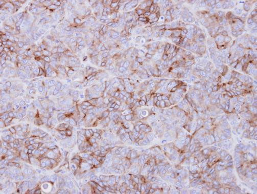 GALR3 Antibody in Immunohistochemistry (Paraffin) (IHC (P))