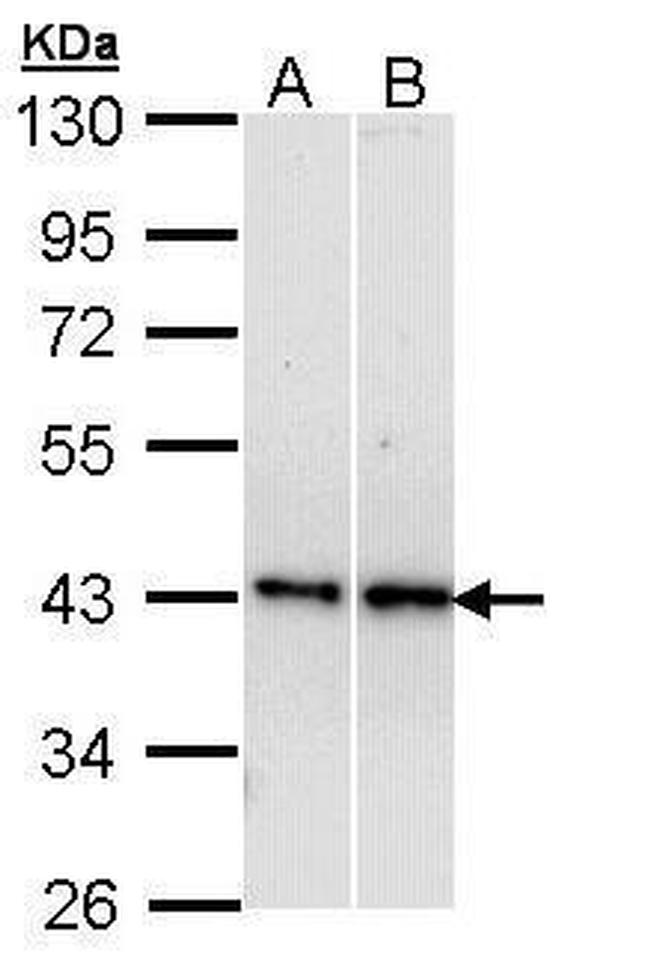 beta-3 Adrenergic Receptor Antibody in Western Blot (WB)