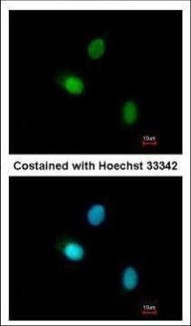 HUNK Antibody in Immunocytochemistry (ICC/IF)