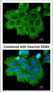 ROCK2 Antibody in Immunocytochemistry (ICC/IF)