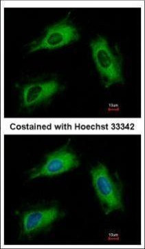 ARL1 Antibody in Immunocytochemistry (ICC/IF)