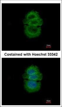 alpha TTP Antibody in Immunocytochemistry (ICC/IF)