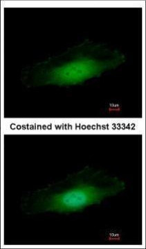 PPP4C Antibody in Immunocytochemistry (ICC/IF)