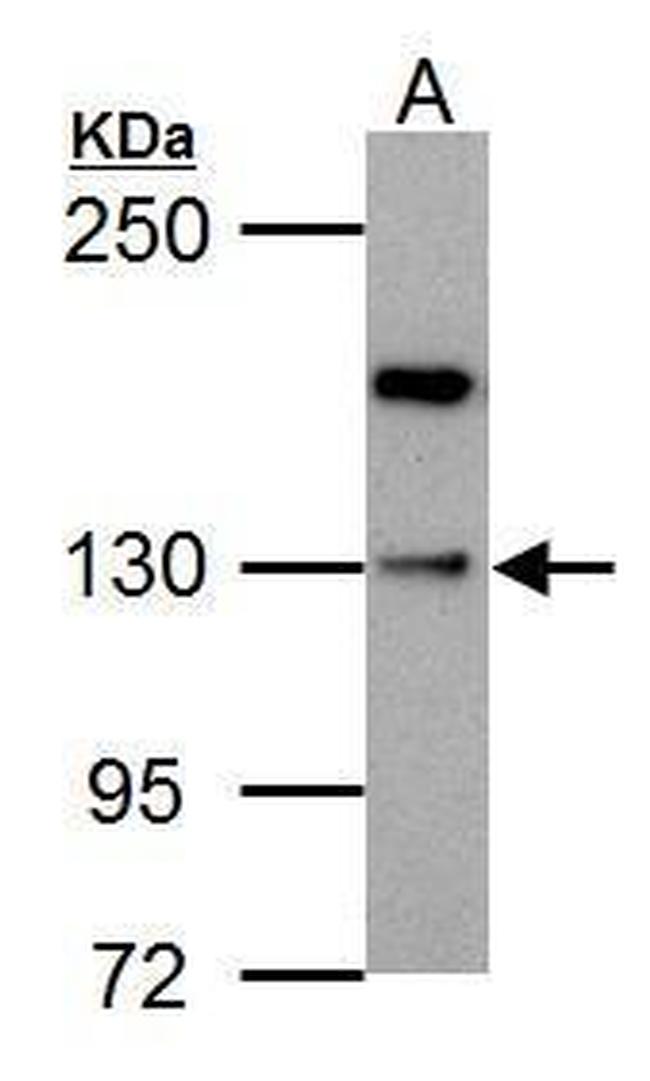 HIPK1 Antibody in Western Blot (WB)