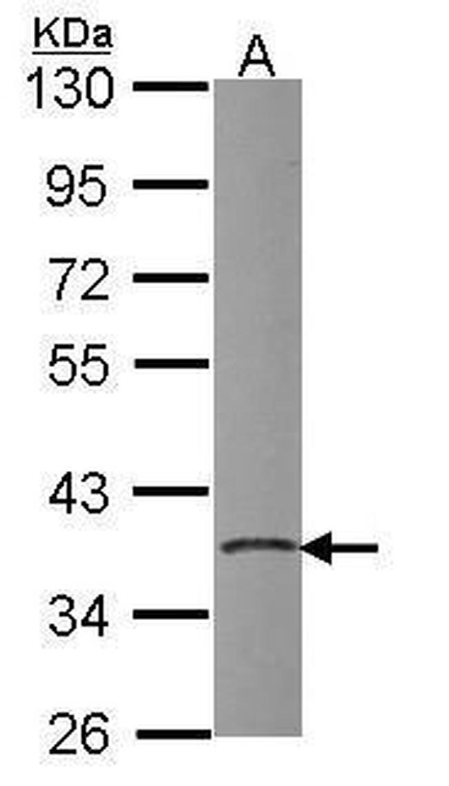 PDIK1L Antibody in Western Blot (WB)