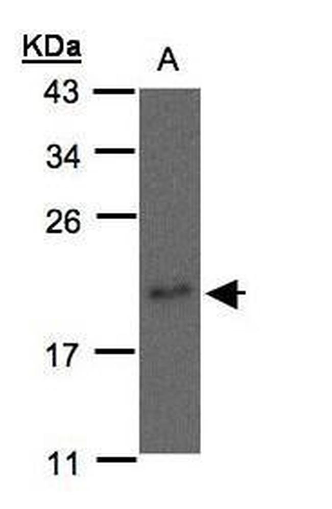 NME3 Antibody in Western Blot (WB)