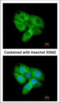 CDK5 Antibody in Immunocytochemistry (ICC/IF)