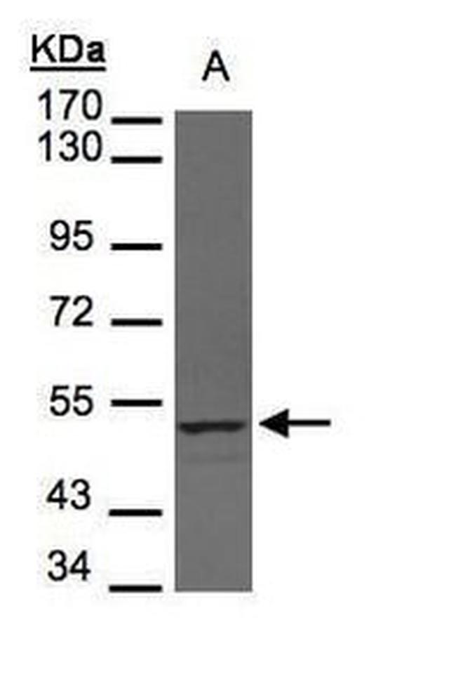 UHMK1 Antibody in Western Blot (WB)