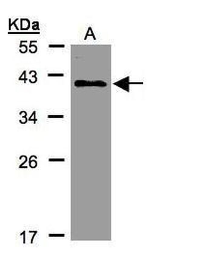 KLHDC8A Antibody in Western Blot (WB)