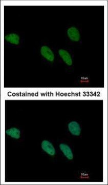 REXO4 Antibody in Immunocytochemistry (ICC/IF)