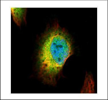Syntenin 1 Antibody in Immunocytochemistry (ICC/IF)
