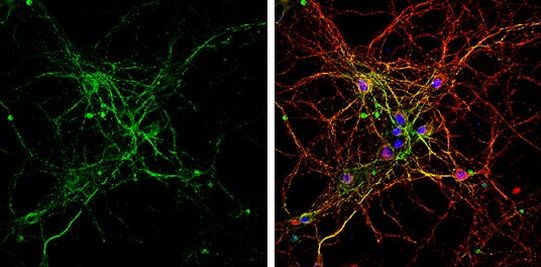 BMP9 Antibody in Immunocytochemistry (ICC/IF)