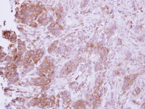 CCL14 Antibody in Immunohistochemistry (Paraffin) (IHC (P))