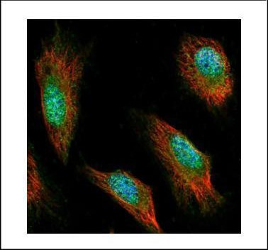 Syntenin 1 Antibody in Immunocytochemistry (ICC/IF)