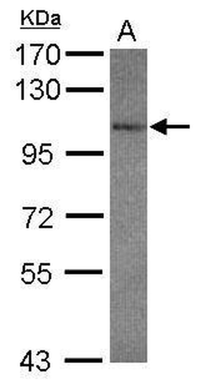 GluR7 Antibody in Western Blot (WB)