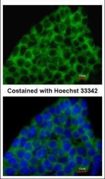 BMP-8A Antibody in Immunocytochemistry (ICC/IF)