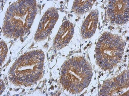 Axl Antibody in Immunohistochemistry (Paraffin) (IHC (P))