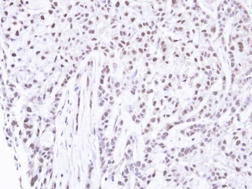 PNK Antibody in Immunohistochemistry (Paraffin) (IHC (P))