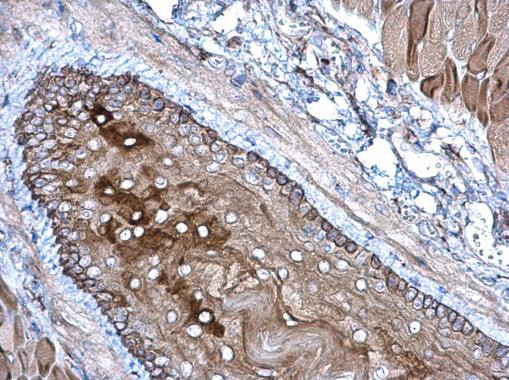 GPX7 Antibody in Immunohistochemistry (Paraffin) (IHC (P))