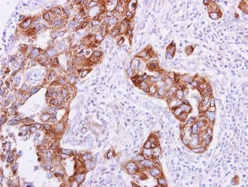 RAB5 Antibody in Immunohistochemistry (Paraffin) (IHC (P))