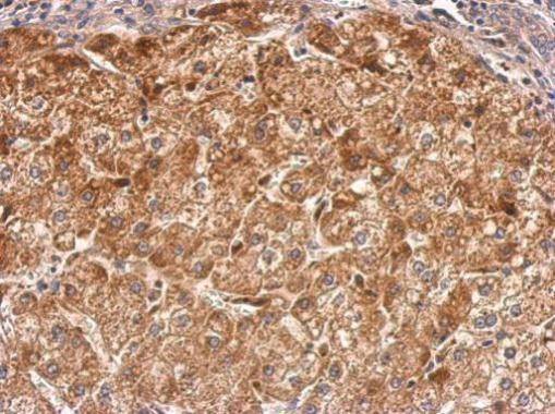 RASGRP2 Antibody in Immunohistochemistry (Paraffin) (IHC (P))