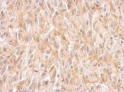 EphB4 Antibody in Immunohistochemistry (Paraffin) (IHC (P))