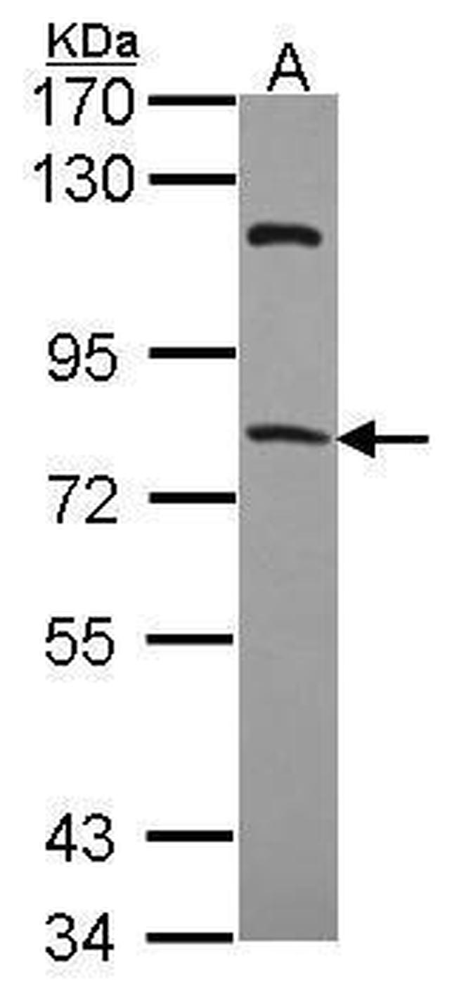 RFX4 Antibody in Western Blot (WB)