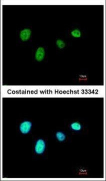 RFX6 Antibody in Immunocytochemistry (ICC/IF)
