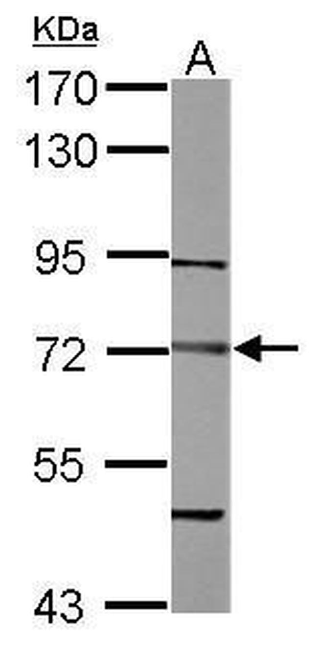 DTNB Antibody in Western Blot (WB)