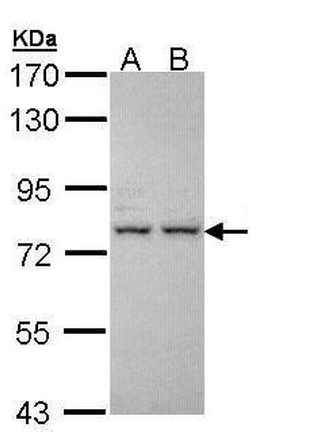 ALS Antibody in Western Blot (WB)
