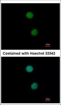 DNA ligase IV Antibody in Immunocytochemistry (ICC/IF)