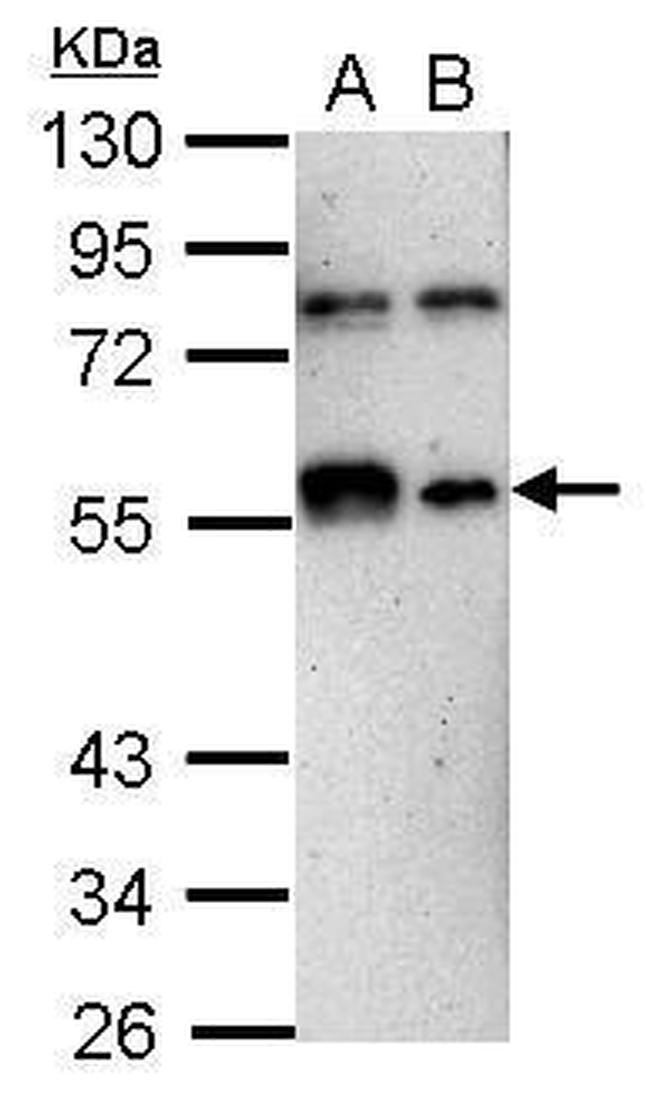 KLF12 Antibody in Western Blot (WB)