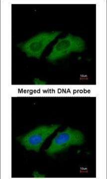 STK33 Antibody in Immunocytochemistry (ICC/IF)