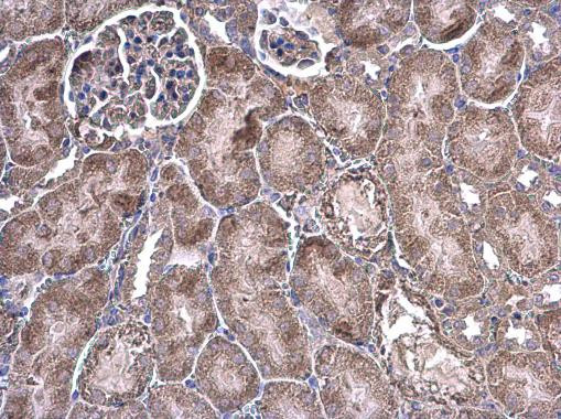 GRB14 Antibody in Immunohistochemistry (Paraffin) (IHC (P))
