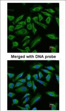 TNIP2 Antibody in Immunocytochemistry (ICC/IF)