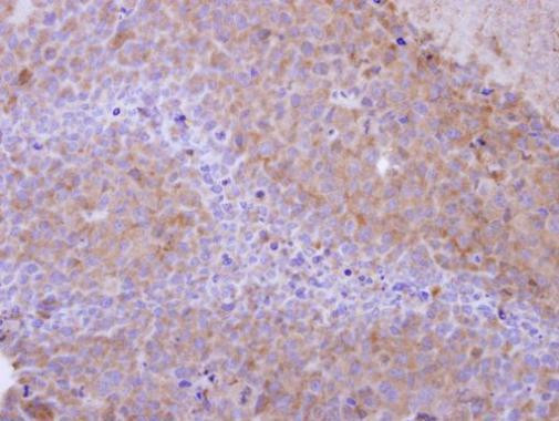 PPP6C Antibody in Immunohistochemistry (Paraffin) (IHC (P))
