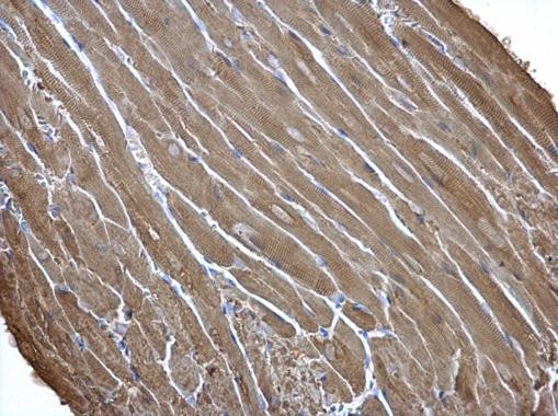 Creatine Kinase MM Antibody in Immunohistochemistry (Paraffin) (IHC (P))