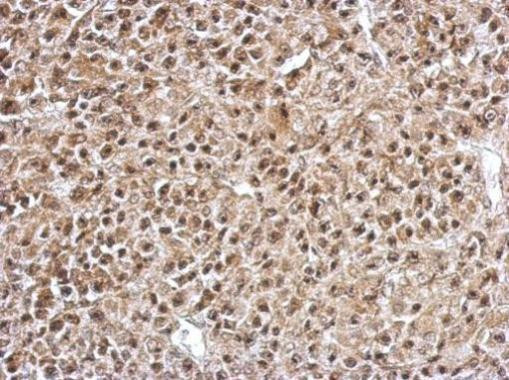 FOXO4 Antibody in Immunohistochemistry (Paraffin) (IHC (P))