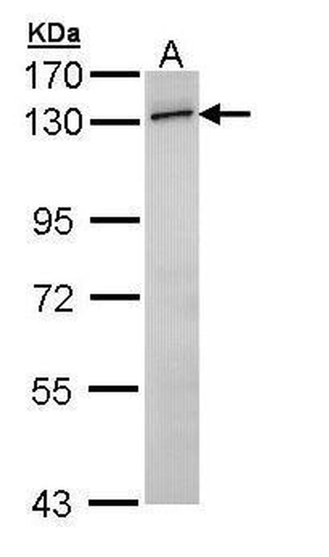 RNF20 Antibody in Western Blot (WB)